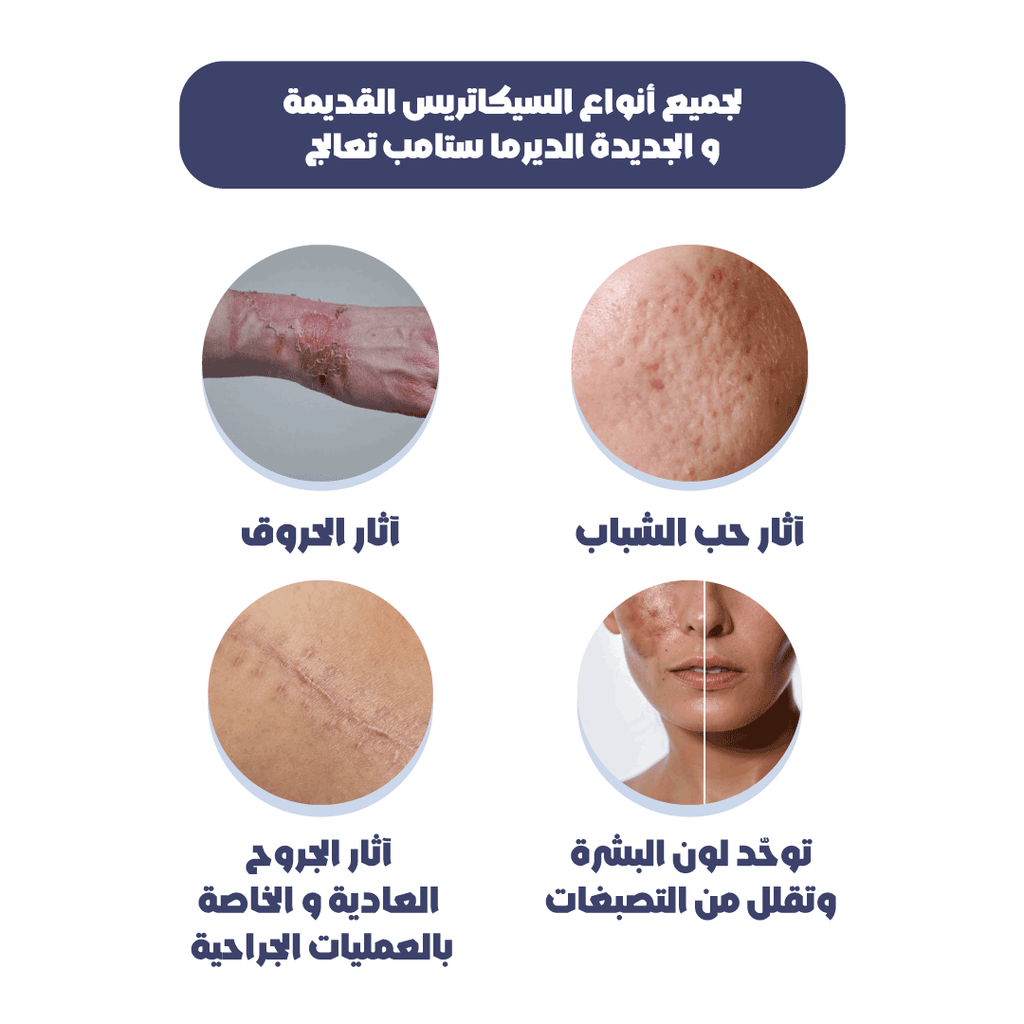 ديرما ستامب لإصلاح البشرة والتخلص من آثار الندبات بفعالية